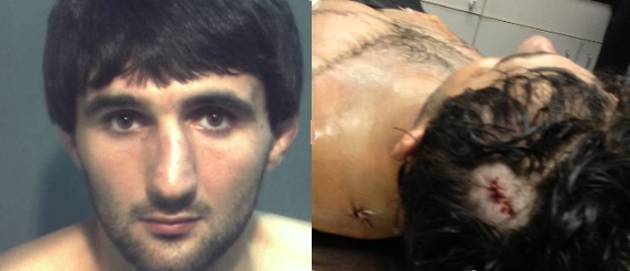 Ibragim Todashev and autopsy photo showing FBI agent&#039;s &quot;kill shot&quot; to the head during a midnight household &quot;interrogation&quot;